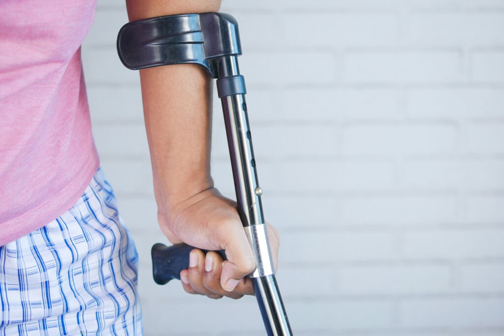 Close-up of injury in personal injury case handled by Khurana Law Firm.